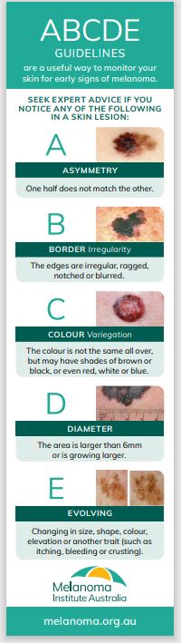 Early sign Of Melanoma